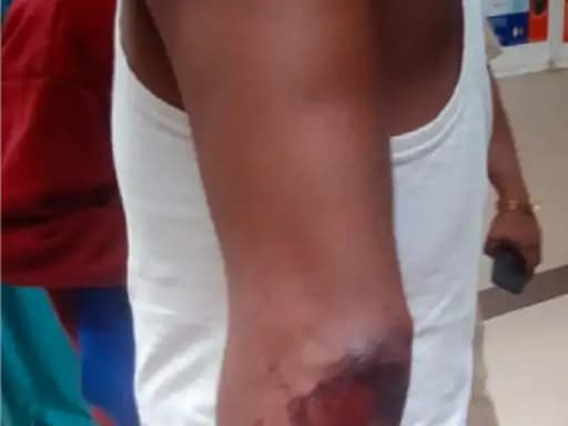 CG NEWS - 2 पक्षों में भारी बवाल, पथराव से कई लोग घायल 42 CG NEWS - 2 पक्षों में भारी बवाल, पथराव से कई लोग घायल March 5, 2026