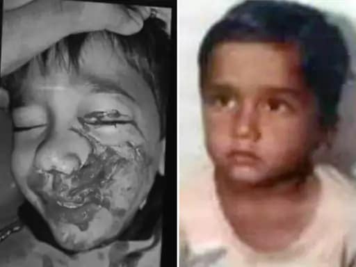 कुत्ते ने मासूम का जबड़ा नोंचा, दांत भी खा गए,भोपाल में 6 साल के बच्चे पर हमला, जबड़े पर 20 टांके आए.. 42 कुत्ते ने मासूम का जबड़ा नोंचा, दांत भी खा गए,भोपाल में 6 साल के बच्चे पर हमला, जबड़े पर 20 टांके आए.. December 2, 2025